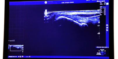 Ecografía Musculoesquelética